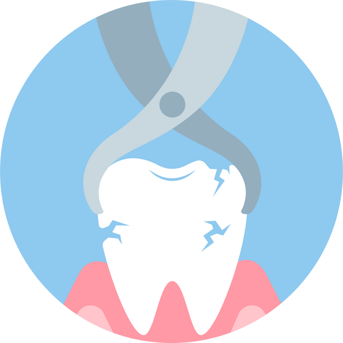 Tooth extraction illustration